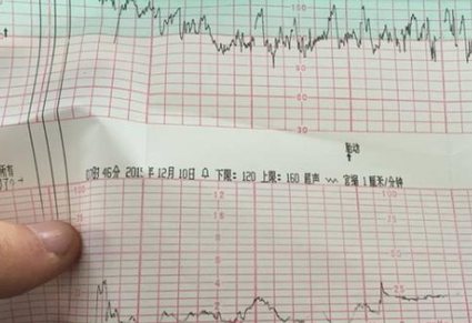 胎心音160次/分以上，怀孕39周请问胎心监护算正常吗房价从140万降到100万胎心音160次/分以上，怀孕39周请问胎心监护算正常吗